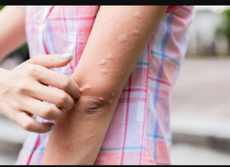 Svi ovo stalno bacaju u smeće, a pojma nemaju čemu služi: TJERA KOMARCE KAO OD ŠALE, VIŠE VAM NEĆE PRIĆI