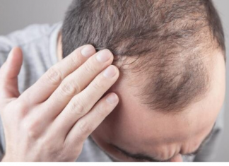 Muči vas opadanje kose? Otkrijte uzroke i prirodna rješenja!