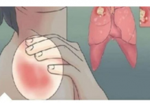 EVO KAKO MOŽETE PROVJERITI DA LI IMATE SLAB IMUNITET: 6 Znakova Lošeg Imuniteta, Ovako Tijelo Upozorava