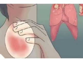 EVO KAKO MOŽETE PROVJERITI DA LI IMATE SLAB IMUNITET: 6 Znakova Lošeg Imuniteta, Ovako Tijelo Upozorava