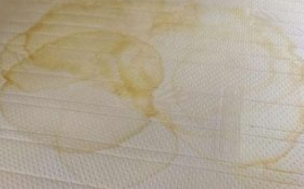 NIKADA SE NE BI SJETILI: Sve fleke sa odjeće skida 1 sredstvo, svi ga imamo u kući