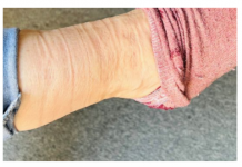 OSTAJU VAM TRAGOVI NA NOGAMA KADA SKINETE ČARAPE? Evo šta to govori o vašem zdravlju, nikako ne ignorište ovu pojavu