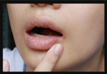 KAKO PREPOZNATI KOJI VAM VITAMIN NEDOSTAJE U TIJELU: Samo obratite pažnju na ove ZNAKOVE