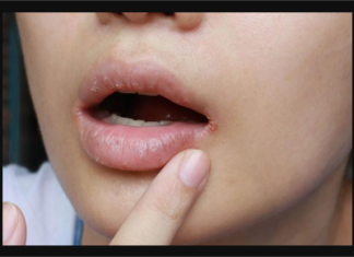 KAKO PREPOZNATI KOJI VAM VITAMIN NEDOSTAJE U TIJELU: Samo obratite pažnju na ove ZNAKOVE