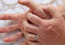 Svrbi vas dlan, mislite da su pare, ko god je to rekao slagao vas je – evo šta znači ako svrbi lijevi ili desni dlan