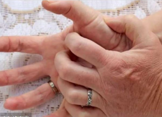 Svrbi vas dlan, mislite da su pare, ko god je to rekao slagao vas je – evo šta znači ako svrbi lijevi ili desni dlan