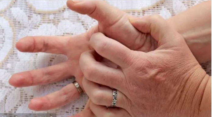 Svrbi vas dlan, mislite da su pare, ko god je to rekao slagao vas je – evo šta znači ako svrbi lijevi ili desni dlan