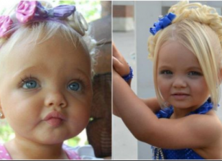 Bila je najljepša beba na svijetu, majka se na njoj obogatila: Sada niko ne vjeruje kako izgleda