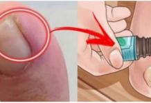 NAJBOLJI SAVJET ZA URASTAO NOKAT: Promjenu ćete osjetiti za nekoliko minuta, a djeluje i protiv modrica i gljivica!