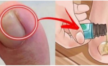 NAJBOLJI SAVJET ZA URASTAO NOKAT: Promjenu ćete osjetiti za nekoliko minuta, a djeluje i protiv modrica i gljivica!