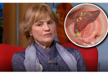 DOKTORKA RADMILA OTKILA KOJE SU NAJBOLJE NAMIRNICE ZA MASNU JETRU: Ono što je rekla o SURUTKI, mnoge će Š0KIRATI