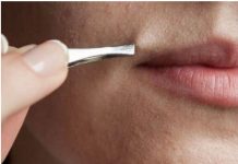 Dosadilo vam je da čupkate dlake: Uklonite ih zauvijek sa 5 minuta masaže ovom smjesom!