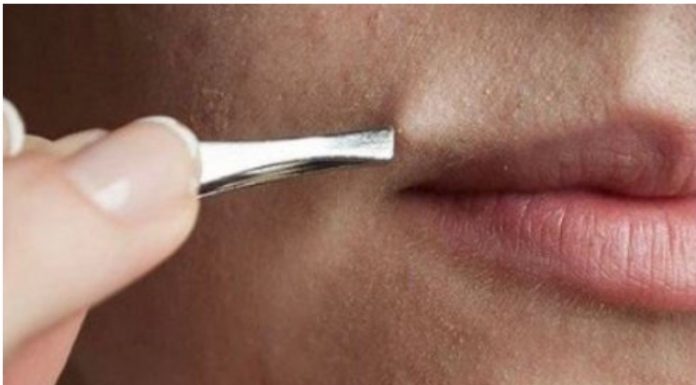 Dosadilo vam je da čupkate dlake: Uklonite ih zauvijek sa 5 minuta masaže ovom smjesom!