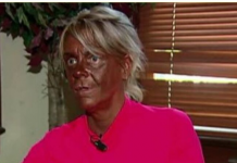 U salone vodila i petogodišnju kćerku: Kako danas izgleda najveća zavisnica od solarijuma na svijetu