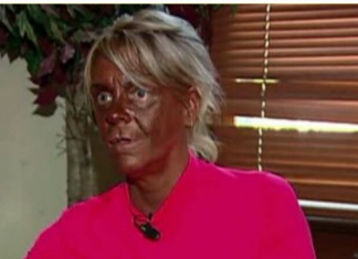 U salone vodila i petogodišnju kćerku: Kako danas izgleda najveća zavisnica od solarijuma na svijetu