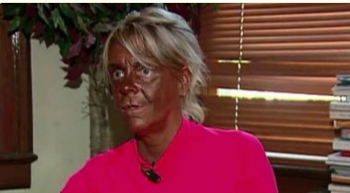 U salone vodila i petogodišnju kćerku: Kako danas izgleda najveća zavisnica od solarijuma na svijetu