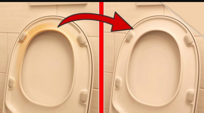 Savršen TRIK moje svekrve za uklanjanje ŽUTE mrlje sa WC daske: Kao nov je!