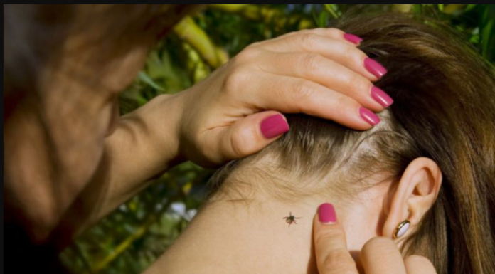 KRPELJI VREBAJU IZ TRAVE: Počinje im sezona, ako ih ne uklonite na vrijeme, u problemu ste, ovo su simptomi