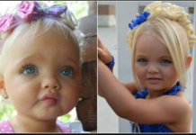 Bila je najljepša beba na svijetu, majka se na njoj obogatila: Sada niko ne vjeruje kako izgleda