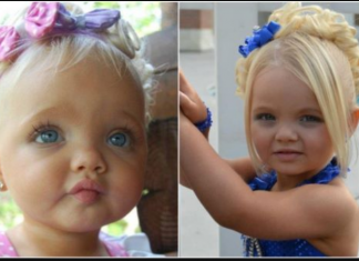 Bila je najljepša beba na svijetu, majka se na njoj obogatila: Sada niko ne vjeruje kako izgleda