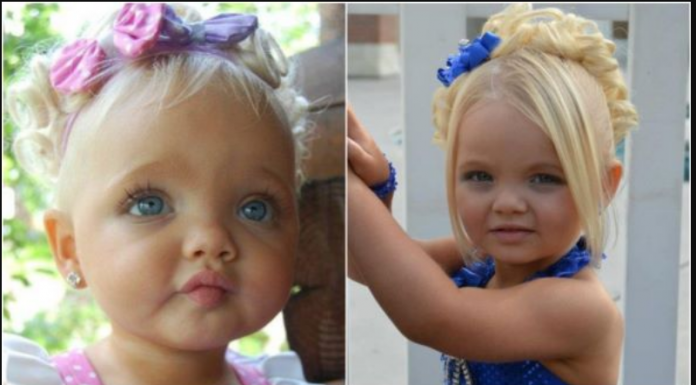 Bila je najljepša beba na svijetu, majka se na njoj obogatila: Sada niko ne vjeruje kako izgleda