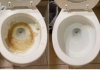Nije sirće ni soda bikarbona: Ovo sredstvo najbolje uklanja kamenac u WC šolji