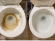 Nije sirće ni soda bikarbona: Ovo sredstvo najbolje uklanja kamenac u WC šolji