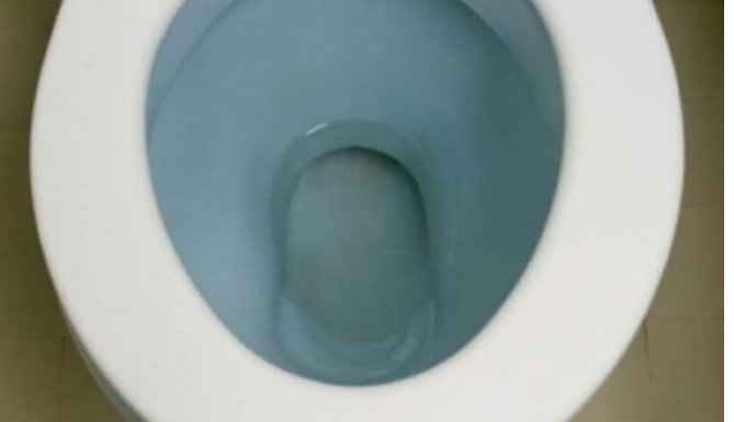STAVILA ČEN BIJELOG LUKA U PRLJAVU WC ŠOLJU SINOĆ: Ujutro ustala i pustila vodu, evo šta se desilo i vi ćete uraditi isto!