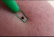 Kako se riješiti omraženih krpelja uz ŠVEDSKI TRIK? To bi svi trebali znati tokom sezone!