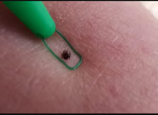 Kako se riješiti omraženih krpelja uz ŠVEDSKI TRIK? To bi svi trebali znati tokom sezone!