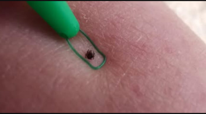 Kako se riješiti omraženih krpelja uz ŠVEDSKI TRIK? To bi svi trebali znati tokom sezone!