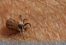 Ova namirnica je spas ako vam se krpelj zakači za kožu: Samo je pospite po njemu