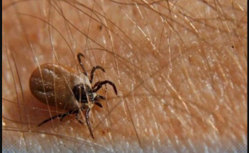 Ova namirnica je spas ako vam se krpelj zakači za kožu: Samo je pospite po njemu