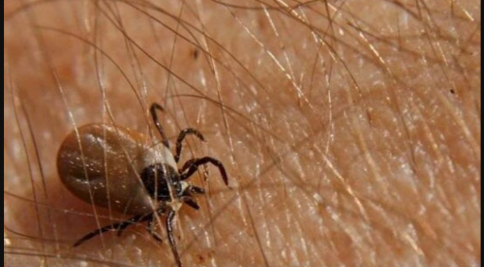 Ova namirnica je spas ako vam se krpelj zakači za kožu: Samo je pospite po njemu