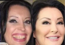 KAD SU SKUPILI PARE, URADILI SU ZUBE: POGLEDAJTE kako su izgledale domaće ličnosti PRIJE UMJETNIH ZUBA – CECA JE HIT (FOTO)