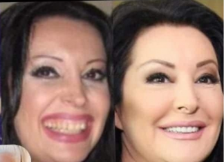 KAD SU SKUPILI PARE, URADILI SU ZUBE: POGLEDAJTE kako su izgledale domaće ličnosti PRIJE UMJETNIH ZUBA – CECA JE HIT (FOTO)