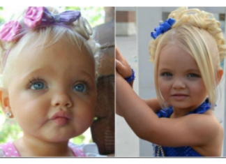 Bila je najljepša beba na svijetu, majka se na njoj obogatila: Sada niko ne vjeruje kako izgleda