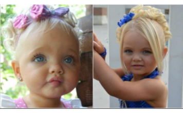 Bila je najljepša beba na svijetu, majka se na njoj obogatila: Sada niko ne vjeruje kako izgleda