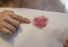 NIKADA SE NE BISTE SJETILI OVOGA: Sve fleke sa odjeće skida JEDNO SREDSTVO koje svi IMAMO kod kuće