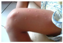 KOMARCI VAM PRAVE PAKAO OD ŽIVOTA? Samo isijecite OVO VOĆE na pola i ostavite u sobi, VIŠE IH NIKADA NEĆETE VIDJETI BLIZU!