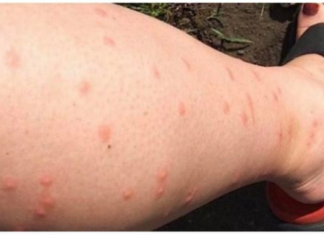 KOMARCI VAM PRAVE PAKAO OD ŽIVOTA? Samo isijecite OVO VOĆE na pola i ostavite u sobi, VIŠE IH NIKADA NEĆETE VIDJETI BLIZU!