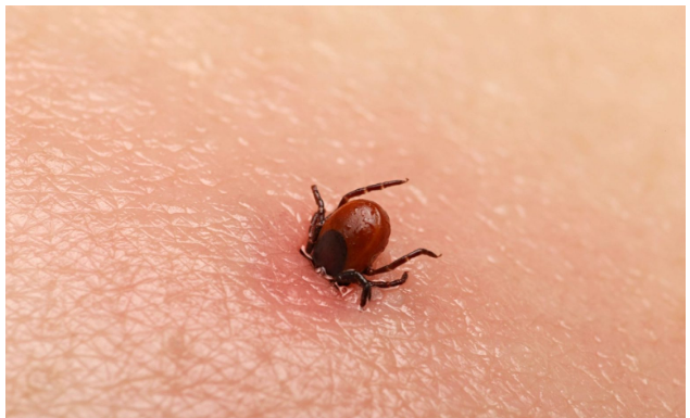 Bezbolno je i nema čupanja: Doktorka otkrila trik kako da se krpelj sam otkači sa kože (video)