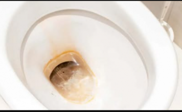 Odličan KUĆNI TRIK kako ukloniti žute mrlje i kamenac u WC šolji bez hemikalija: Testirano, djeluje odmah!