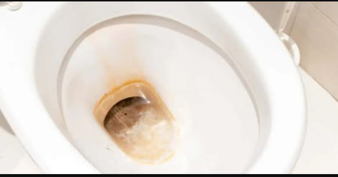 Odličan KUĆNI TRIK kako ukloniti žute mrlje i kamenac u WC šolji bez hemikalija: Testirano, djeluje odmah!