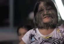 DEVOJKA SA LICEM MAJMUNA SE UDALA PA OBRIJALA LICE: Kada su je videli, ljudi se šokirali! Pogledajte kako SADA IZGLEDA