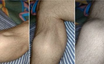 Uhvatio vas je grč u nozi? Uradite odmah OVO i bol nestaje za par sekundi