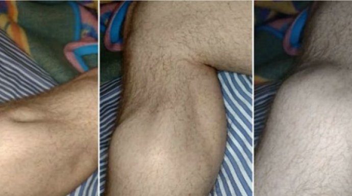 Uhvatio vas je grč u nozi? Uradite odmah OVO i bol nestaje za par sekundi