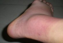 OSLOBODITE ZGLOBOVE OD NAGOMILANE SOLI: Magičan rastvor ruskog travara za 2 sedmice potpuno oporavlja koštani sistem