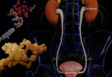 MUČE VAS ČESTE URINARNE INFEKCIJE? Ove namirnice HITNO izbacite iz ishrane – one POGORŠAVAJU stanje!