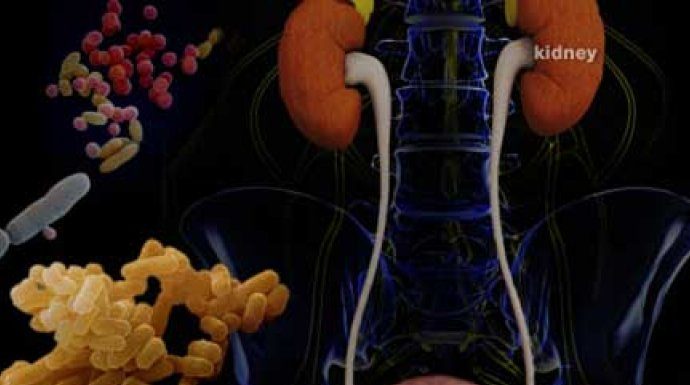 MUČE VAS ČESTE URINARNE INFEKCIJE? Ove namirnice HITNO izbacite iz ishrane – one POGORŠAVAJU stanje!